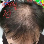 핀페시아 photo review