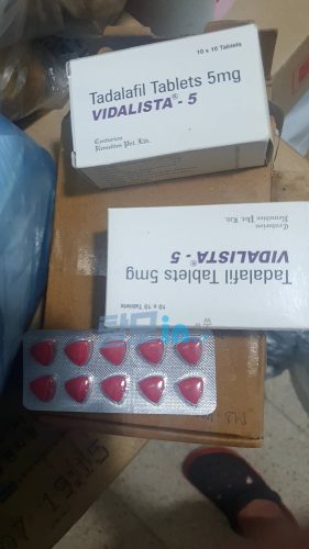 비달리스타 5 photo review